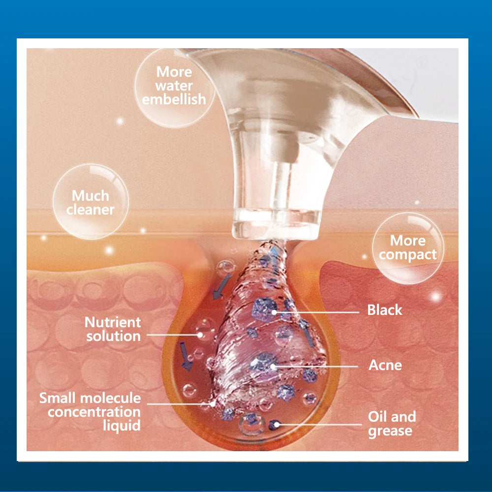 Electric Skin Vacuum  Cleanser by KinseiBeauty