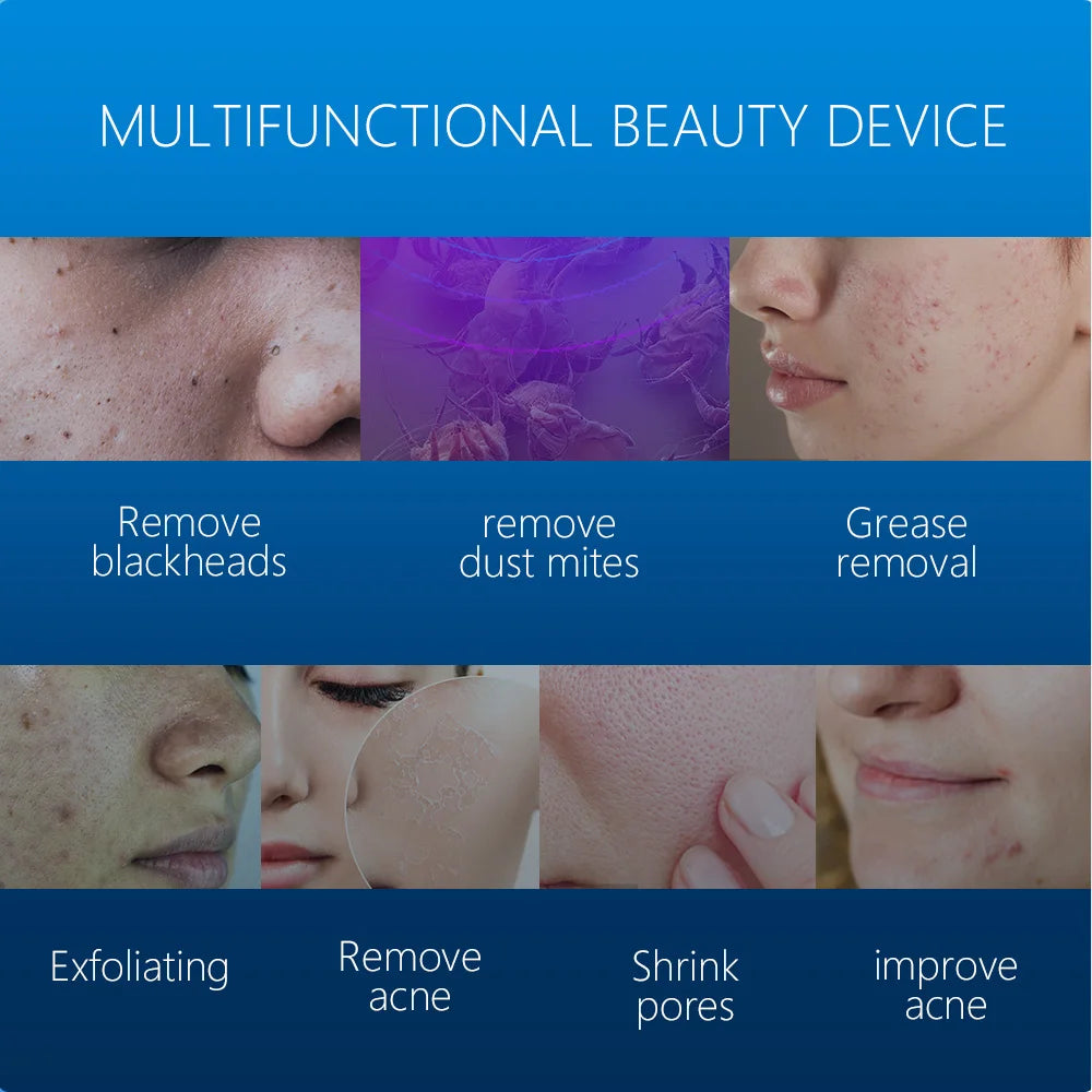 Electric Skin Vacuum  Cleanser by KinseiBeauty