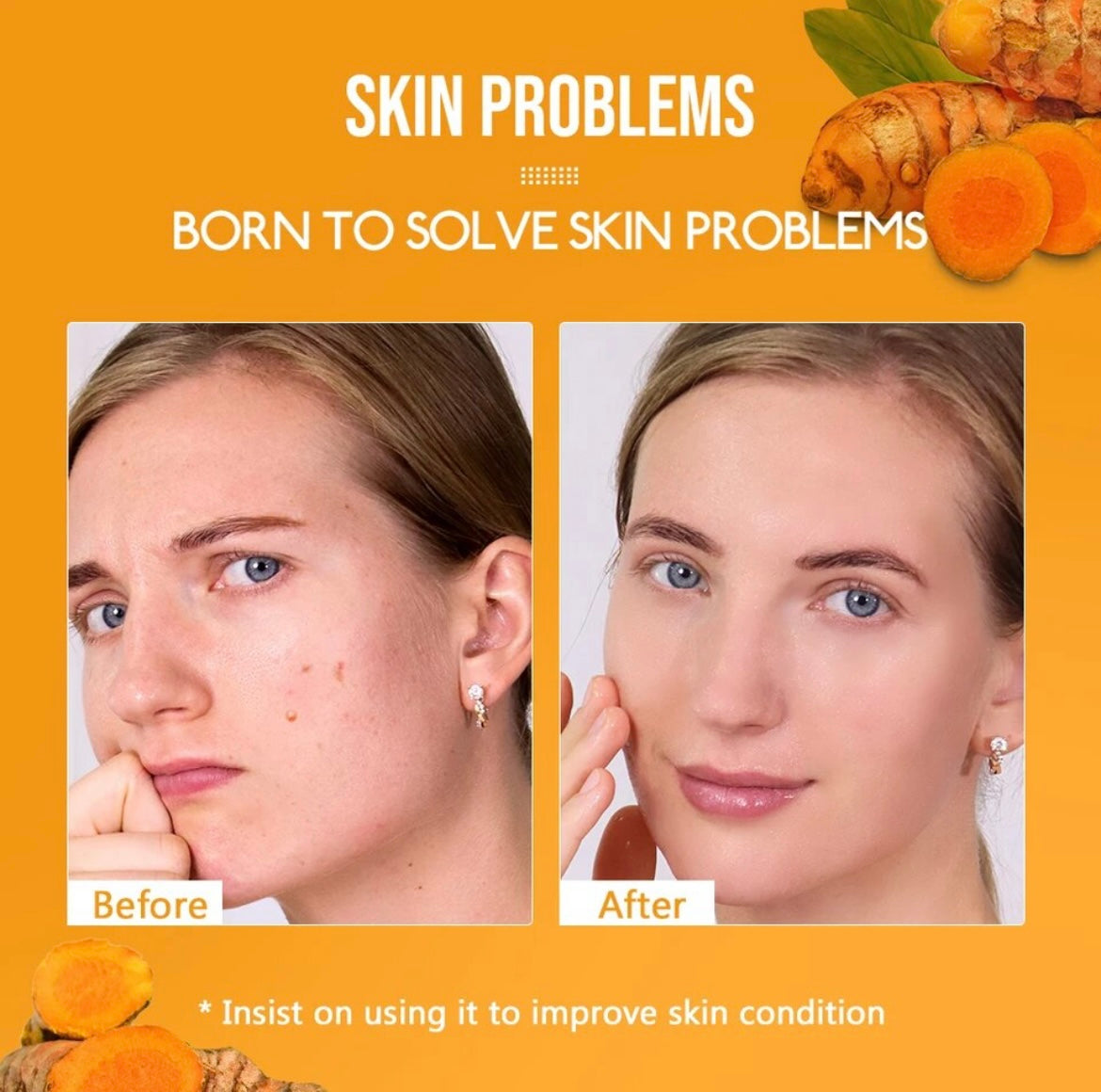 LIYAL’AN 8pcs Turmeric Skin Care Set