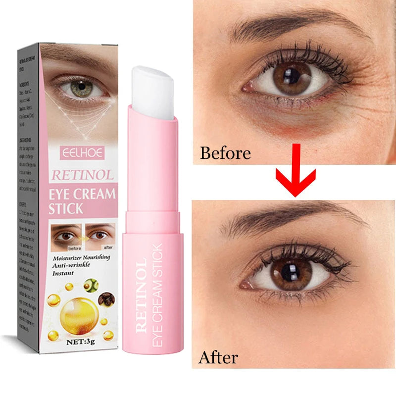 Retinol Eye Cream Instant Removing Dark Circle Moisturizing Beauty Stick