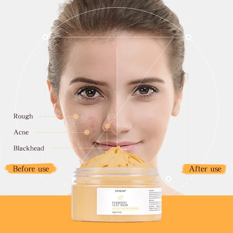 LIYALAN  Anti Acne Vitamin C Turmeric Face Clay Mask